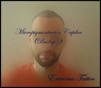 /album/micropigmentacion/tricopigmentacion-capilar-badajoz-x1-jpg/